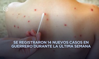 Guerrero se coloca en cuarto lugar nacional con más contagios de sarampión