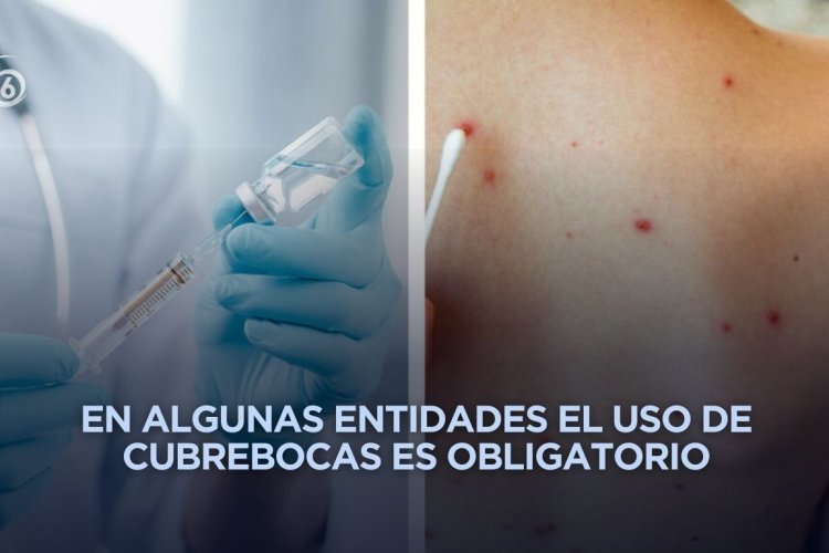 Refuerzan medidas en varios estados ante brote de sarampión en México