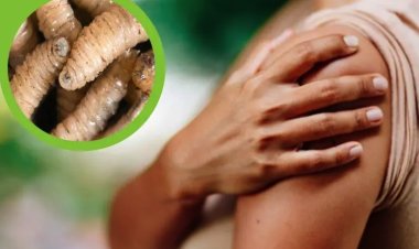 Detectan en CDMX casos de gusano barrenador en humanos